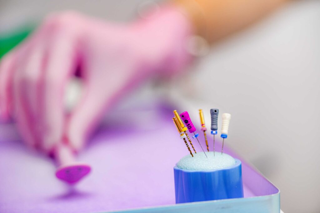 Tratamientos-endodoncia-óptima-dental